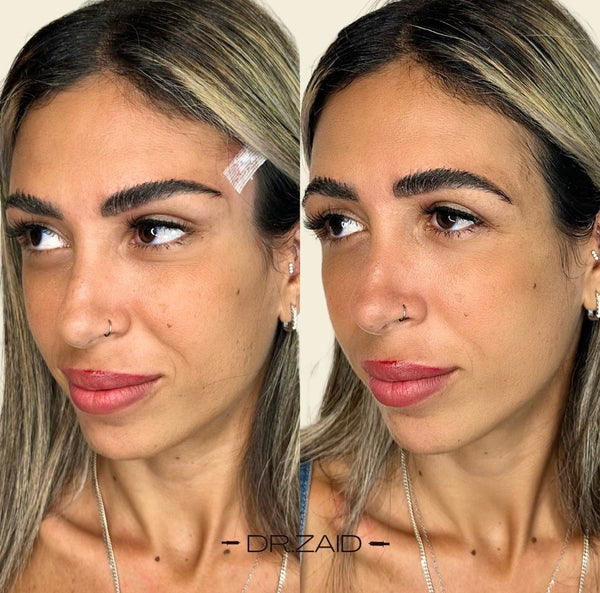 לפני - 